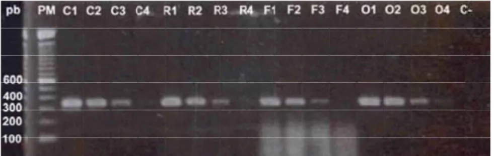 Figura 4 – Gel de agarose a 2%. Visualização de banda de 331pb, amplificado de segmento  de DNA de leptospira, de amostras de suspensão de tecidos (rim, fígado e ovário)  contaminadas nas concentrações de 2,0x10 4 ; 2,0x10 3 ; 2,0x10 2 ; e 2,0x10 1  leptos