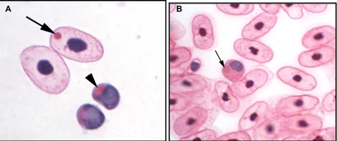 Figura  5.  Esfregaço  sanguíneo  de  Boa  constrictor  com  IBD.    Coloração  H-E.  A)  Eritrócito  (seta)  e  linfócito  (ponta  de  seta)  contendo  inclusões  eosinofílicas