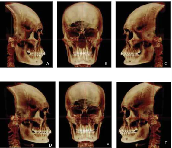 FIGURA 7- Observam-se os planos axial, coronal e sagital, de T1 e T2, do mesmo paciente,  passando pelas mesmas estruturas