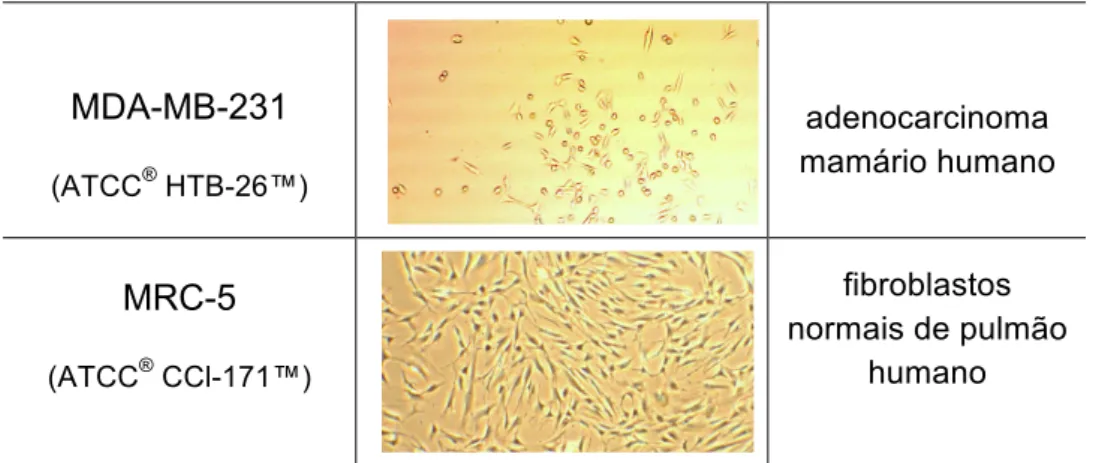 Figura  5. Fotomicrografia das diferentes linhagens celulares humanas utilizadas para avaliar a atividade  citotóxica  dos  complexos  SCAR