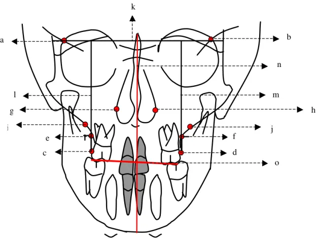 Figura 12 – Pontos cefalométricos, planos e linhas   d f c ea b m lk g h n ij o 