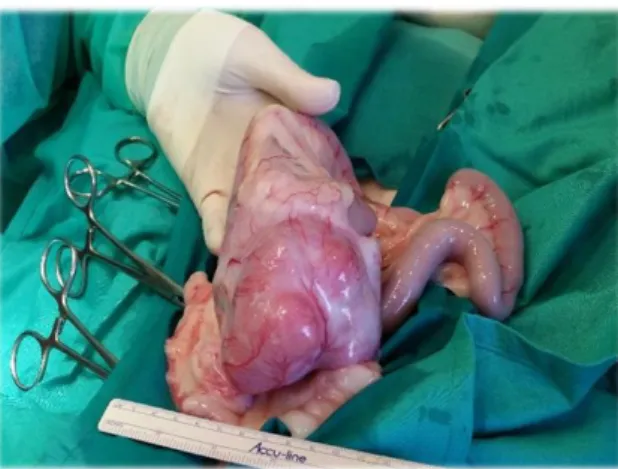 Figura  6.  Imagem  intra-operatória  de  um  leiomiossarcoma  no  cão  (Imagem  gentilmente  cedida  pelo  HVUTAD).