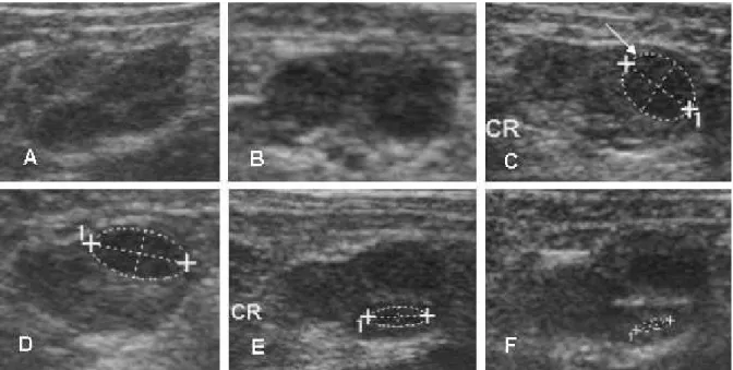 Figura 1: Imagens ultra-sonográficas da dinâmica do crescimento folicular e desenvolvimento luteal do ovário  direito do animal n° 02