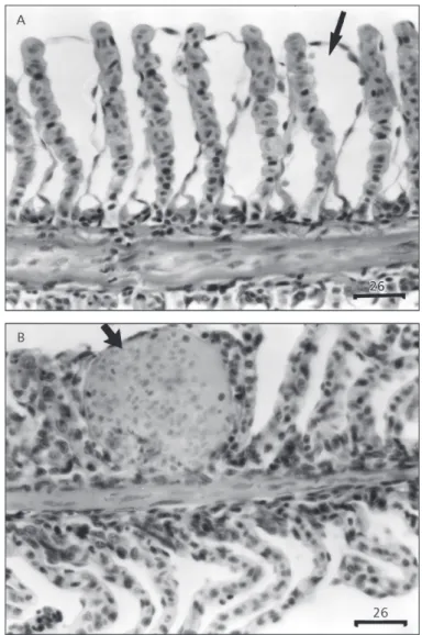 Fig. 1 — Sections of gill filament of P. lineatus. A – Fish exposed to 24 mg Pb.L –1  for 96 h