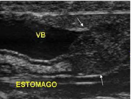 Figura 1. Imagem ultrassonográfica em plano longitudinal do fígado de cascavel (Caudisona  durissa terrifica)  Fonte: Priscilla Macedo de Souza 