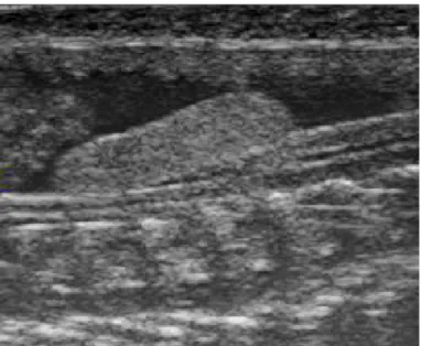 Figura  4.  Imagem  ultrassonográfica  em  plano  longitudinal  do  testículo  (seta)  de  cascavel  (Caudisona durissa terrifica)