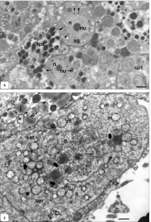 Fig. 2 — A. Light microscopy (LM) showing nuage (arrow´s head) in spermatogonia (sg). n, nucleus; nu, nucleoli; spt, spermatids;
