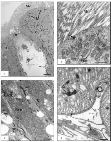 Fig. 5 — Ultrastructural aspects of columnar cell (C) with microvilli (Mv) and mitochondria (M)
