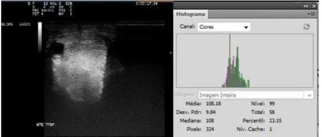 FIGURA  13:  Sonograma  do  tendão  flexor  digital  profundo  (TFDP)  com  área  demarcada  pelo  programa  Photoshop  CS4 ®   de  0,5cm  x  0,5cm  para  realização  do  histograma