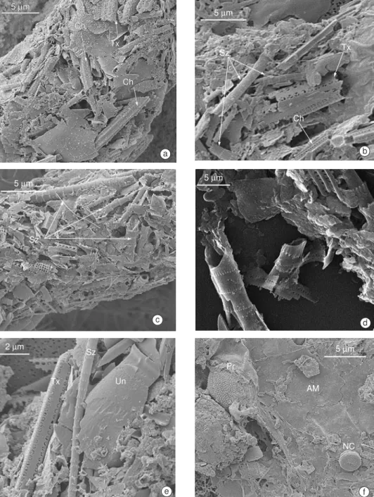 Fig. 2 — Contents of fecal pellets from the copepods C. velificatus (a and b) and P. parvus (c and d) and the Euphasiacea  Euphasia sp (e and f) at P1, Jan/97