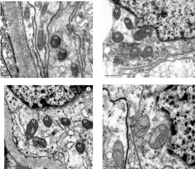 Fig. 1-4 — Transmission electron micrographs showing brown spider testes fixed with 1) FS 1; 2) FS 2; 3) FS 4; and 4) FS 5
