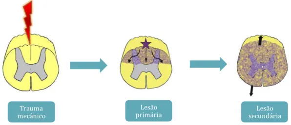 Figura 2 – Lesões após o trauma medular. No momento do trauma, ocorre a lesão primária que acarreta  a ruptura de axônios, corpos neuronais e células da neuroglia, resultando na interrupção da passagem dos  impulsos  nervosos