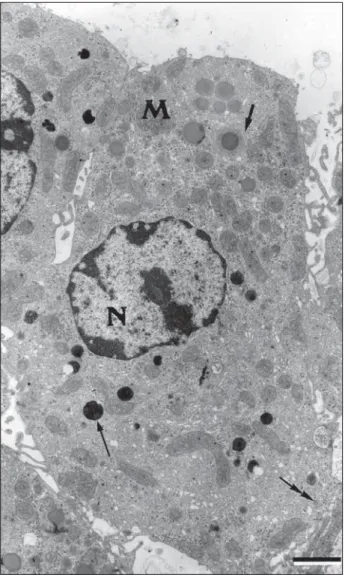 Fig. 3 — An electron micrograph of a melatonin treated mouse Leydig cell. N = cell nucleus; M = mitochondria; thin ar- ar-row = lysosome; thick arar-row = smooth endoplasmic reticulum; double arar-row = rough endoplasmic reticulum