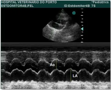 Figure 4: Right parasternal short-axis at aortic valve level; Two dimensional and corresponding M-mode image  below (note the “leading edge to leading edge” method of measurement); LA = left atrium, Ao = aorta  
