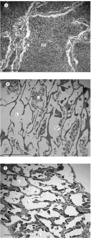 Fig. 2 — Histological sections of Oligosarcus hepsetus testis in different maturity classes