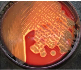 Fig. nº 4 –Staphylococcus aureus confirmation with a bacteriological culture in blood agar  (Buxton, 2005).
