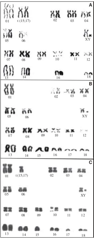 Figura 1. Cariótipo de Sus s. scrofa L. machos, sob colora- colora-ção convencional, apresentando 2n = 36 cromossomos (A);