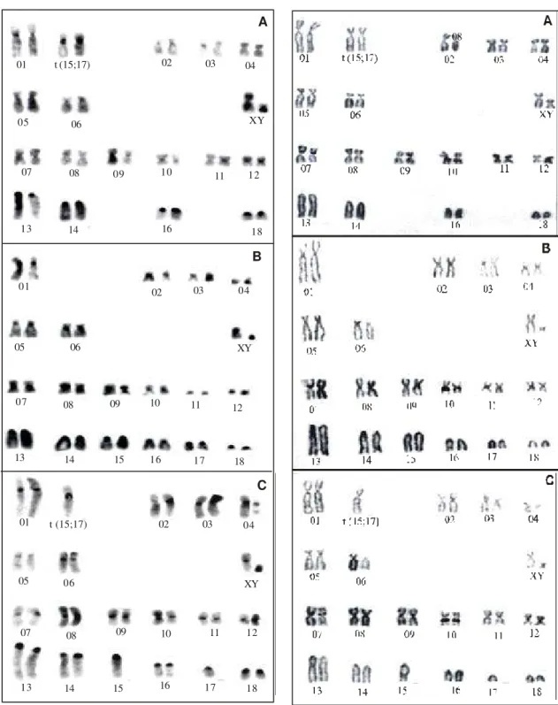 Figura 2. Cariótipo de  Sus s. scrofa L. machos, sob bandamento C,  apresentando  2n = 36 cromossomos (A);