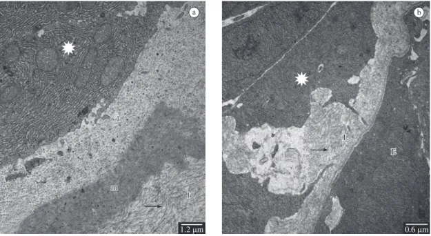 Figure 3. a) Electron micrograph of a longitudinal section of a regenerating lepidotrichia after 8 days of regeneration of a fish  from control group