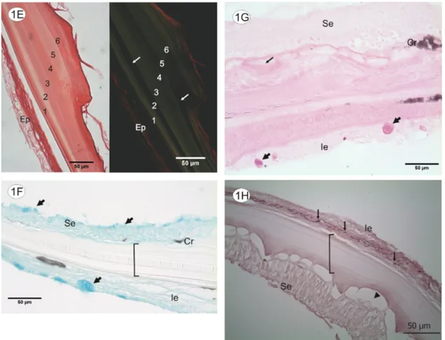 Figure 1 (cont.) - E: Scale stained with Picrosirius Red under polarized light (right) and without it (left)