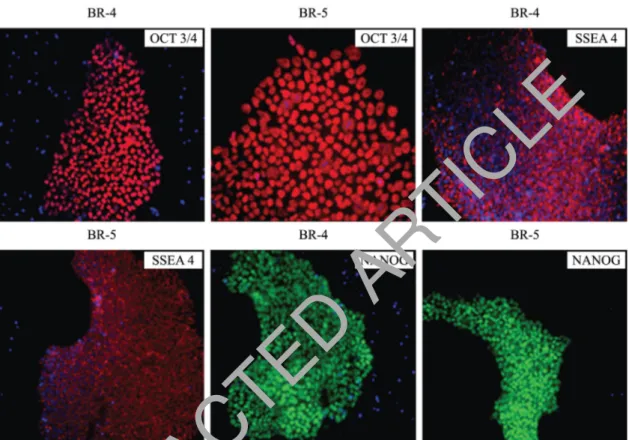 Figure 3.  Characterization of hES cells lineages (BR-4 and BR-5) by ICC technique. Colonies of BR-4 and BR-5 staining  positive for markers of pluripotency such as OCT3/4 (red), SSEA-4 (red) and NANOG (green)