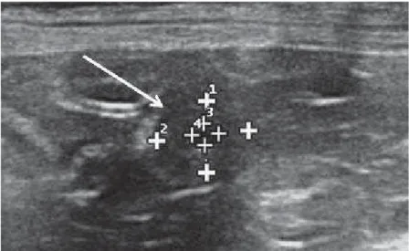 Figure 1. Ultrasound imaging of the early-stage and ecobiometry of the gestational sac in  Shi-Tzu bitches.