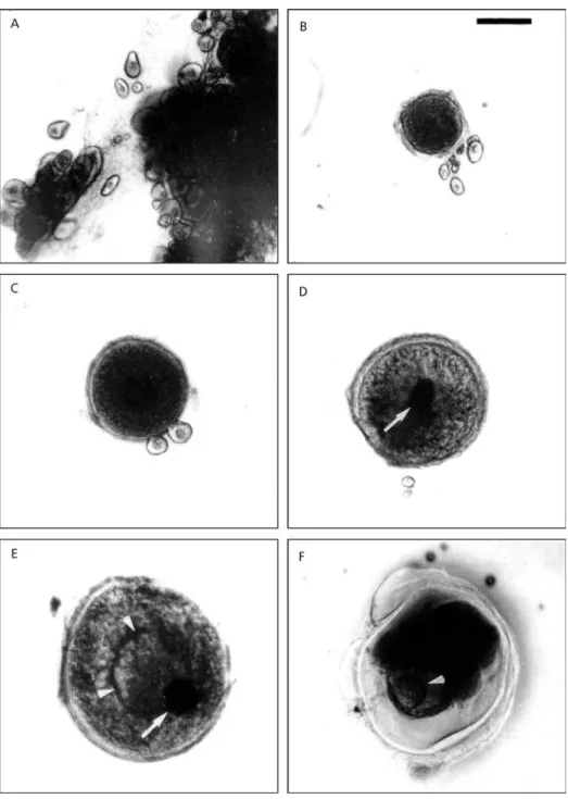 Fig. 2 — Microphotographs of fixed oocytes: A – pre-vitellogenic oocytes; B-C – vitellogenic oocyte; D – fully-grown or postvitellogenic oocyte (arrow indicates the central germinal vesicle position); E – maturing oocyte with germinal vesicle migration (ar
