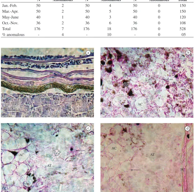 Figure 1.  Histology and histopathology of the skin of Mugil platanus. a) normal skin, H&amp;E (400x); b) Ulceration of the skin  with loss of the normal structure and showing colonies of bacteria, adipose cells and amorphous tissue, Gram  Method (400x); 