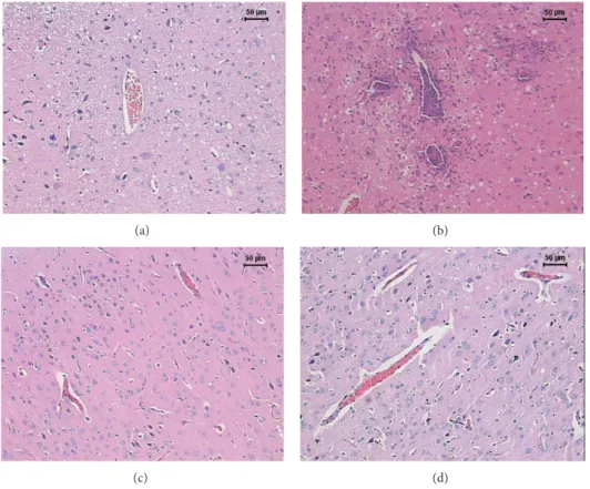 Figure 2: Efect of tuberculosis vaccines in brain inlammation associated with EAE. Female Lewis rats were immunized with BCG alone or with BCG followed by pVAXhsp65 boosters and then underwent EAE induction by inoculation of MBP emulsiied with CFA