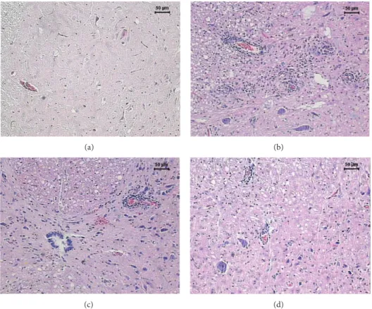 Figure 3: Efect of tuberculosis vaccines in spinal cord inlammation associated with EAE