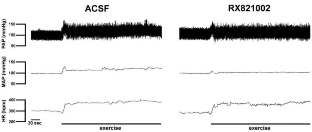 Fig. 7. Time-course of changes in mean arterial pressure (⌬ MAP) and heart rate (⌬ HR) during dynamic exercise on the treadmill (0.8 km/h for 6 min) in rats that had received bilateral microinjection of vehicle (ACSF, Œ, n⫽7) or the nonselective ␤-adrenoce