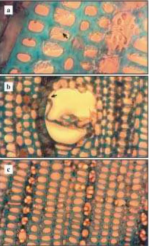 Figura 1. Cortes transversais do lenho de seringueira do clone IAN 6543 corados com azul de toluidina (objetiva 100x, ocular 10x), em plantas com (a e b) e sem (c)  sinto-mas de deficiência de boro, apresentando: a) descolamento das paredes dos elementos d