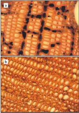 Figura 2. Cortes transversais do lenho de seringueira do clone IAN 6543 corados com lugol (objetiva 40x, ocular 10x) mostrando a presença (a) e a ausência (b) de grãos de amido no parênquima radial e longitudinal de plantas sem (a) e com (b) sintomas folia