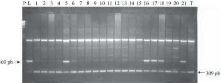 Figura 1. Gel de agarose com amostras amplificadas com o primer OP-AP20. P: padrão molecular; L: limão ‘Cravo’;