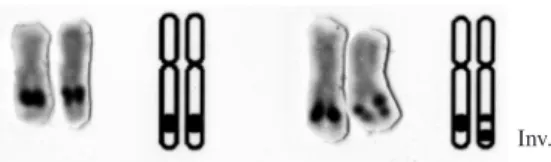 Figure 1. Chromosomes of the rainbow trout (Oncorhynchus  mykiss) stained with Silver nitrate, showing the nucleolar  or-ganizer regions (NOR)