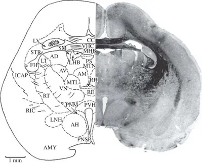 Figure 10. AD, anterodorsal thalamic nucleus; AH, anterior nucleus of hypothalamus; AM, anteromedial nucleus of thalamus;