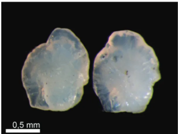 Figure  29.  Sagitta otoliths of Pimelodella australis  (Eigenmann, 1917) (FL= 11.6 cm; OL= 2.52 mm).