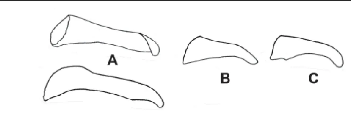 Figure 10. Valva.  (A) A. conspicua, dorsal (top) and ventral (bottom) views; ventral view of (B) A