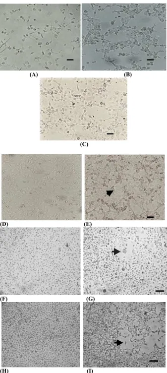 Fig. 1:  Characteristic of MDBK monolayer grown on VP-SFM  medium; (A) 10% of monolayer confluence; (B) 30% of  monolayer confluence; (C) 80% of monolayer confluence; 