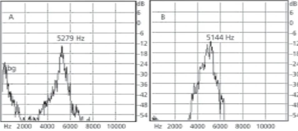 Fig. 4 — Advertisement call of Hyla sanborni: power spectrum of (A) first note (type A – Introductory), note intensity and energy concentration at around 5200 Hz