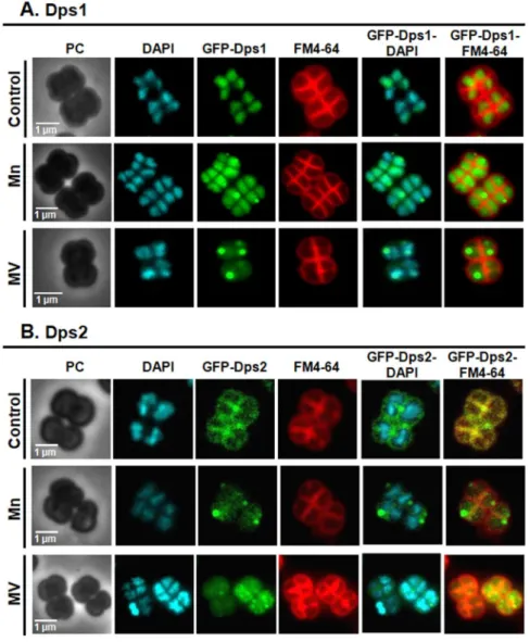Figure 4.  D. radiodurans GFP-Dps1 and GFP-Dps2 cellular localization using epifluorescence microscopy