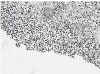 Figure 1. Experimental paste 1 (45 days). Presence of organized  connective tissue with proliferation of blood vessels and absence  of inlammatory process (Original magniication ×157.5).