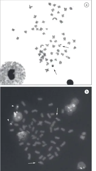 Figure  1. Somatic  metaphases  of  Iheringichthys  labrosus  submitted to treatment with AgNO 3  (a) and FISH with 18S  and 5S rDNA probe (b)