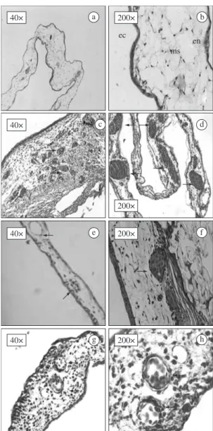 Figure  3.  Treatment  using  S.umbellatum  latex  (Detail  of   Figure  2h)  Note  the  presence  of  fibroconjunctive  tissues,  blood vessels well formed, nuclear erythrocytes within the  lumen of new vasculature and inflammatory elements