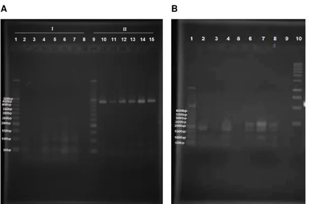 Figura 4. Digestões com endonucleases do gene 16S de duas linhagens de T. 