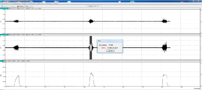 Figura 2 - Mostra como o software BioMed foi utilizado para o processamento  off-line dos sinais, para o  traçado de um dos sujeitos do grupo experimental 