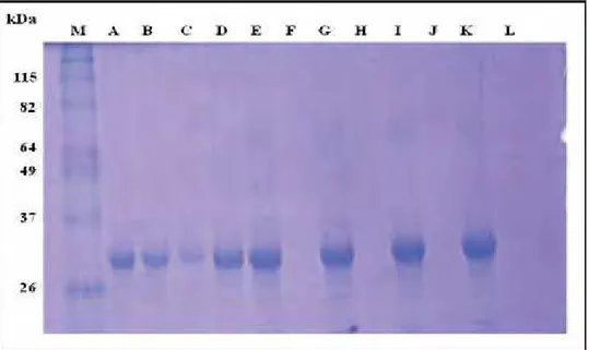 Figura 9. SDS- PAGE a 12% mostrando o experimento de reenovelamento da proteína  recombinante