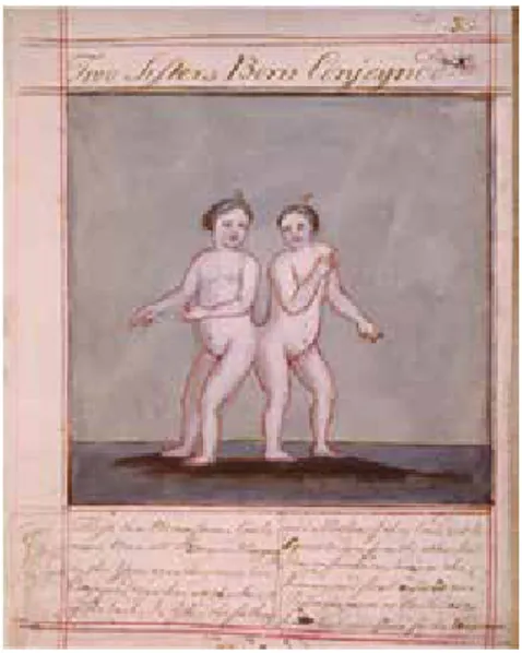 Figure 1. James Paris Duplessis, “Two sisters  born conjoined”, from A Short History of Human  Prodigious and Monstrous Births  (British Library,  Sloane MS 5246).