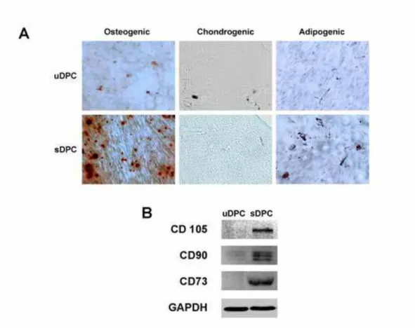 Figure 2 – Stemness of uDPC and sDPC – A) Osteogenic differentiation (Alizarin Red  staining under phase microscopy; 40x); Chondrogenic Osteogenic differentiation (Alcian  Blue staining, 40x) and Adipogenic Osteogenic differentiation (Oil Red O staining un