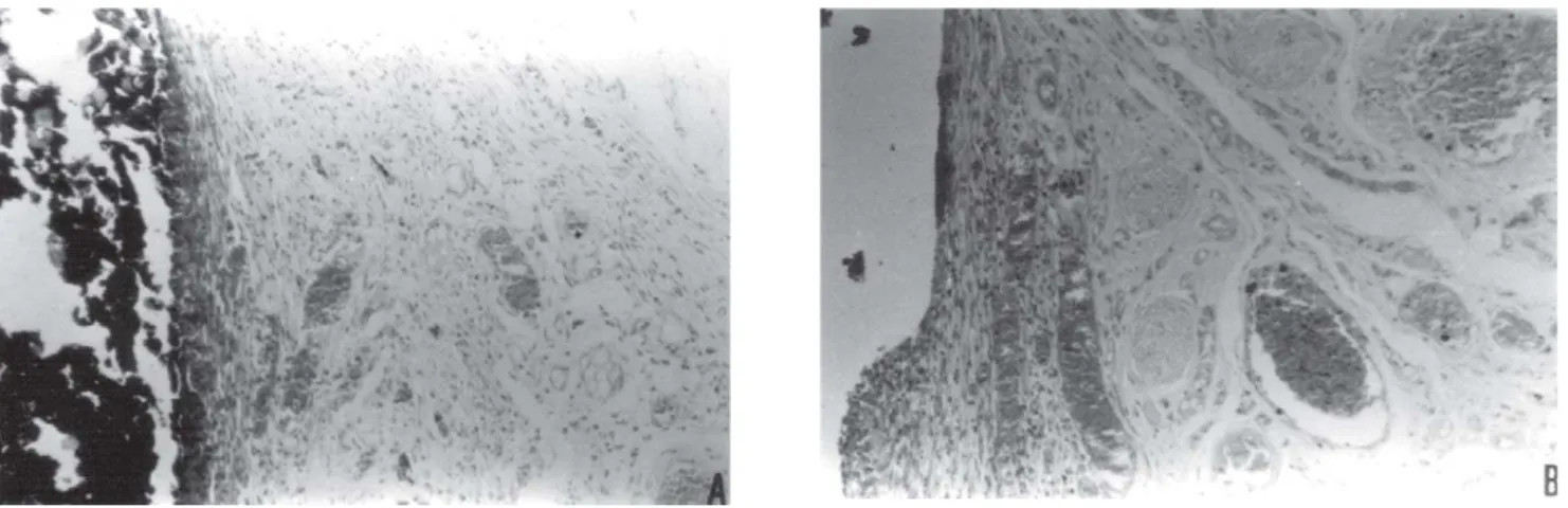FIGURE 2- Response of the connective tissue in contact with Apexit cement (arrows): 14-day experimental period (A) and 90- 90-day experimental period (B)